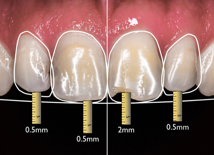 デジタルスマイルデザイン｜いばた歯科