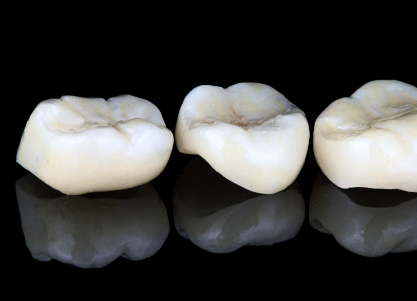 ジルコニア｜いばた歯科