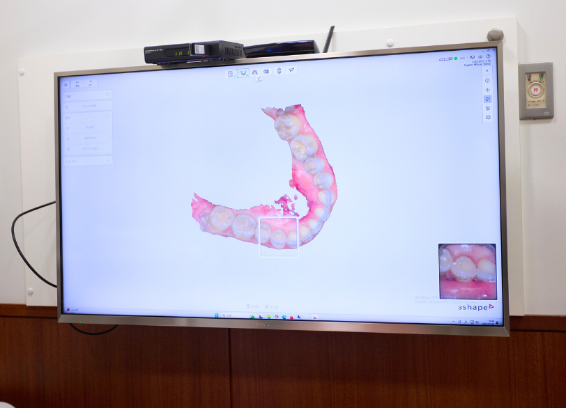 AIによる3Dシミュレーション｜いばた歯科