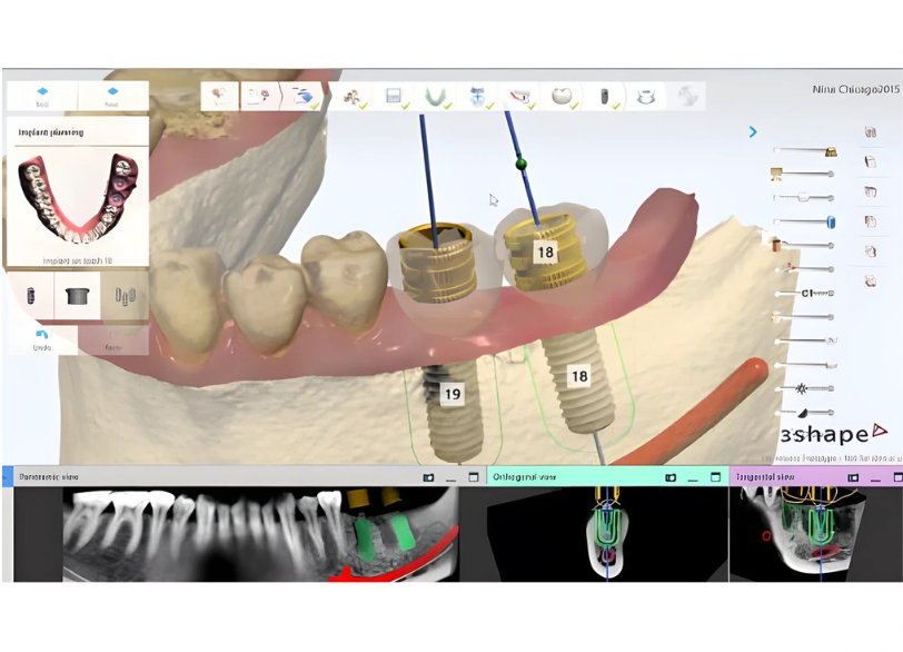 デジタルシミュレーション｜いばた歯科