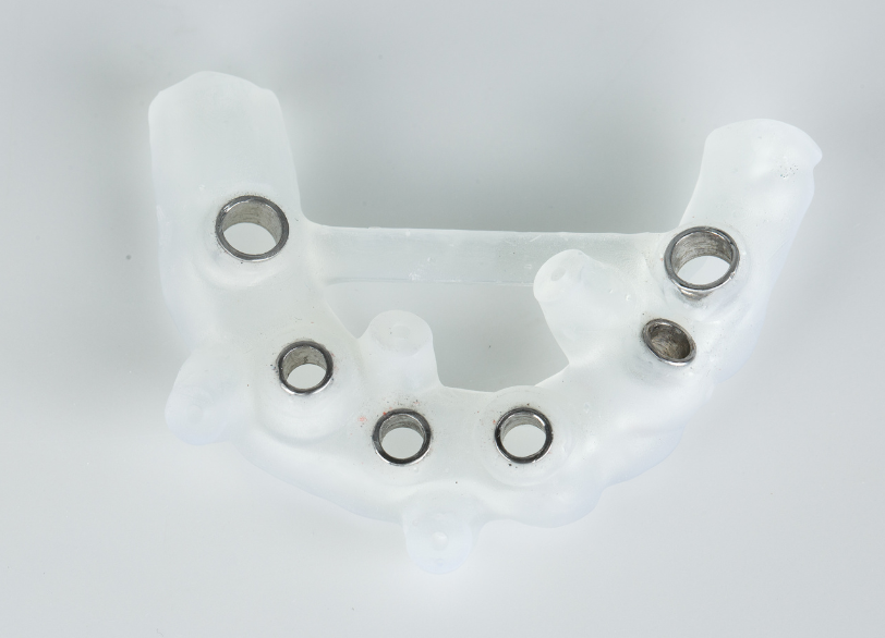 サージカルガイド｜いばた歯科