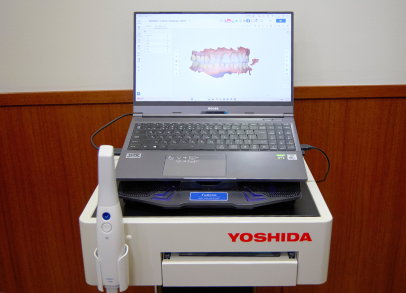 トップ４口腔内スキャナー｜いばた歯科