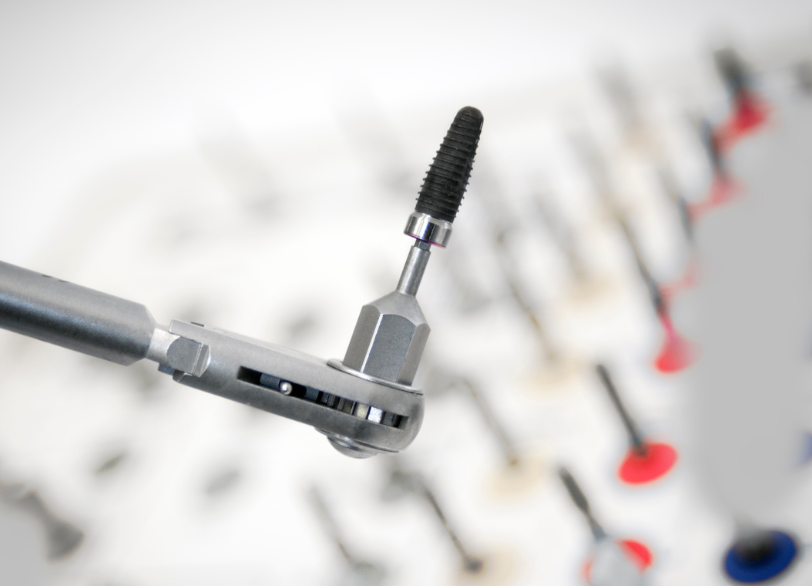 インプラント治療を検討されている方へ｜いばた歯科