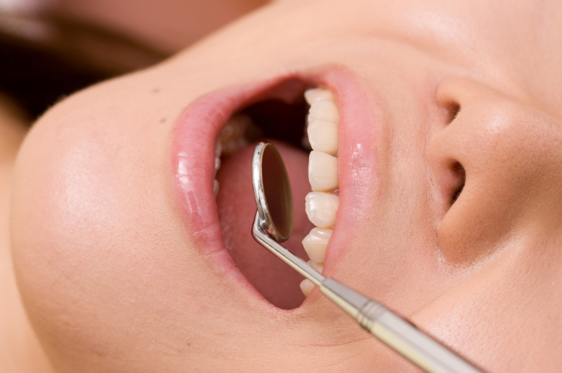 虫歯予防のために歯科検診を受ける様子