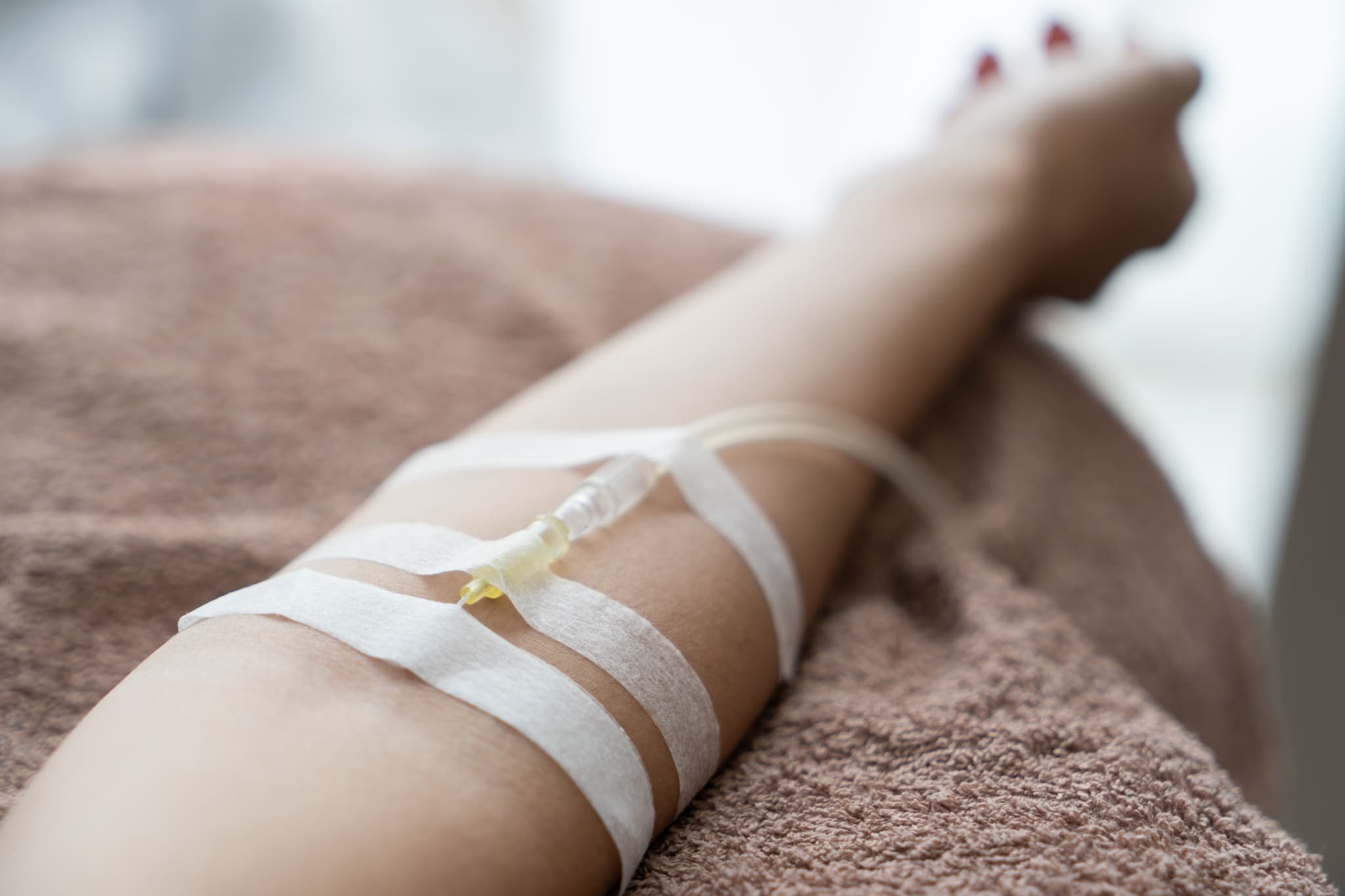 点滴で麻酔をする様子