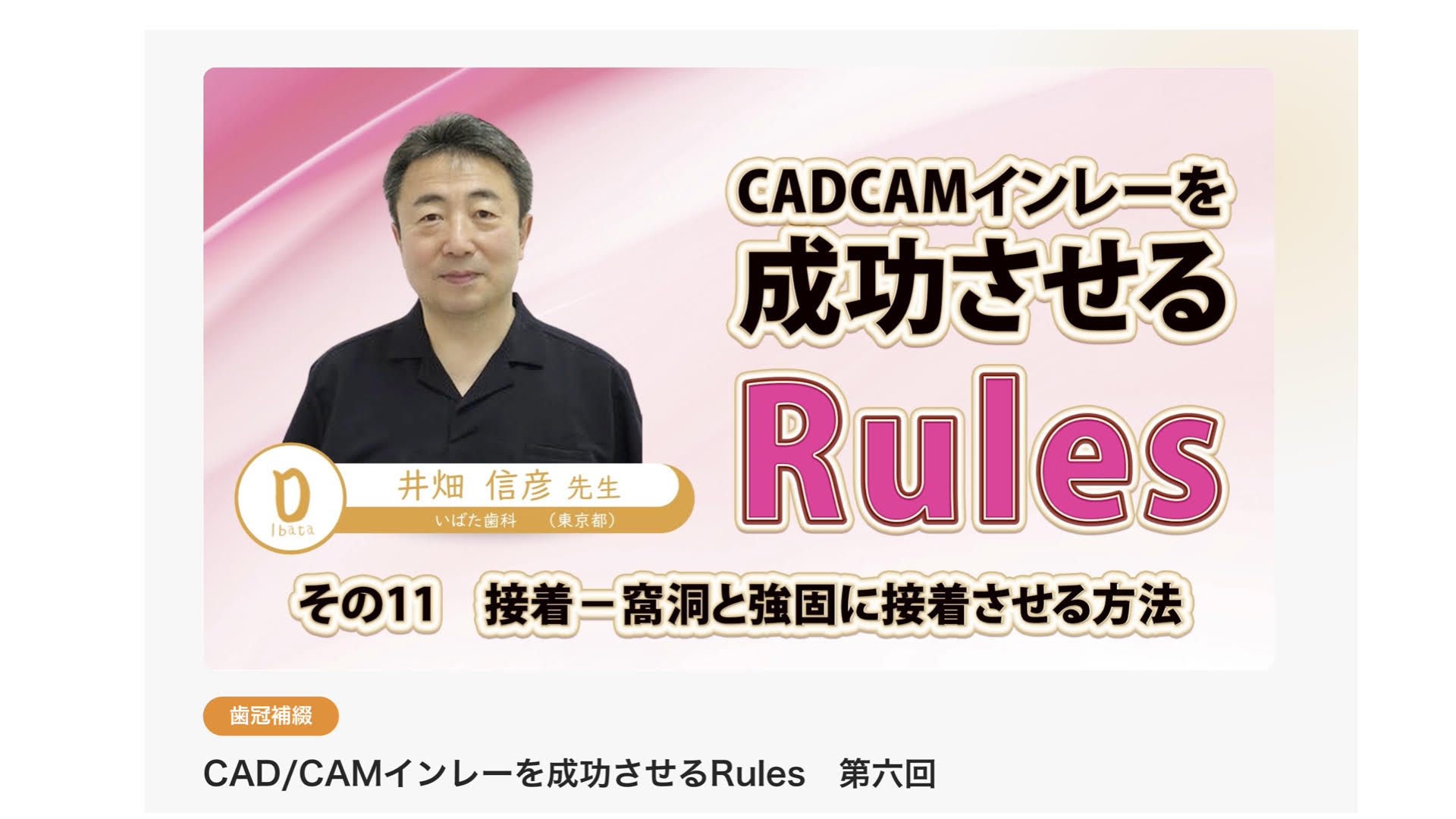 CAD/CAMインレー治療についての解説動画