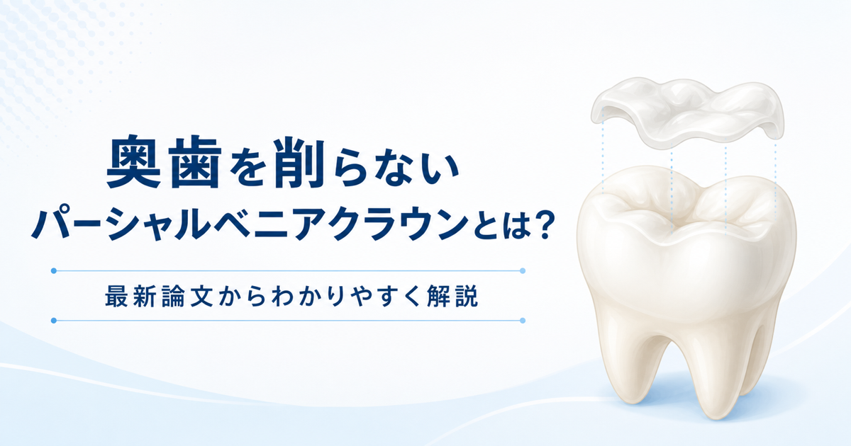 奥歯を削らないパーシャルベニアクラウン（オクルーザルベニア）の解説記事のイメージ画像